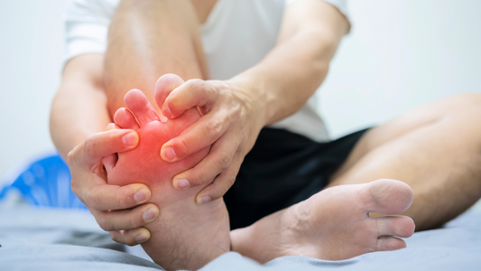 Finding Relief: My Top 3 Natural Remedies for Gout